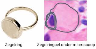 Beeld zegelringcel